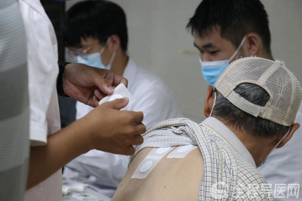入伏第一天，防病第一帖—— 徐州市中醫院冬病夏治“三伏貼”今日開貼