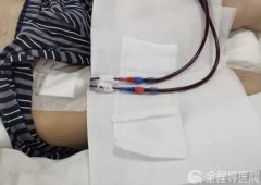 徐州一院腎內科：中心靜脈置管后，要注意哪些？